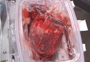 Caja transparente lleva corazones latientes y frescos para sus nuevos portadores