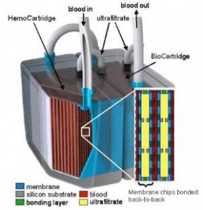 Cientficos desarrollan el primer prototipo de rin artificial implantable